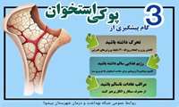   ۳ گام پیشگیری از پوکی استخوان
